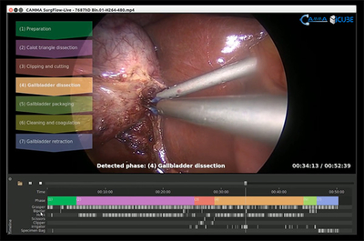 Screenshot of the SurgFlow prototype for online and offline automatic surgical video analysis.