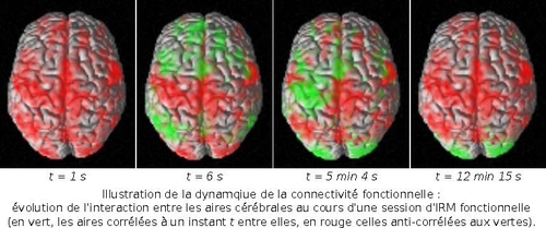 Illustration de la dynamique de la connectivité fonctionnelle