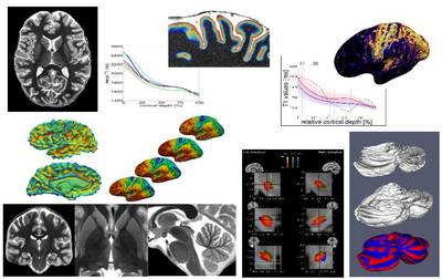 In-vivo analysis of brain anatomy at 7 Tesla